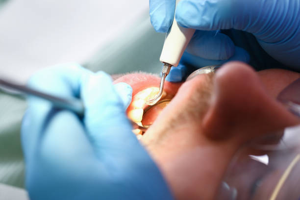 Emergency Dentist for Kids in WY