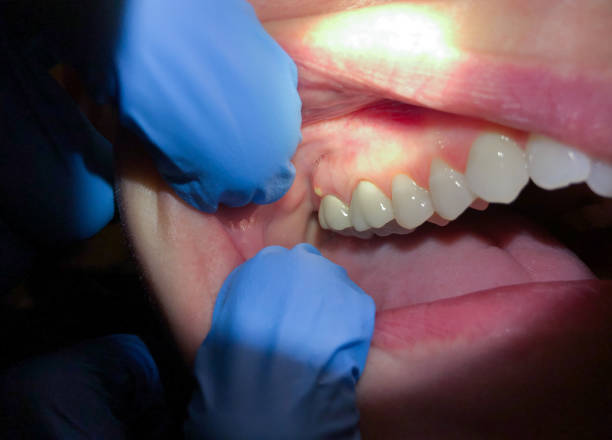 Dentist for Dental Trauma in WY